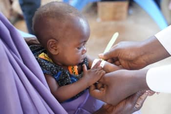 Nine-month-old Fawzia* receiving treatment for malnutrition at Save the Children's health clinic in Baidoa, Somalia.